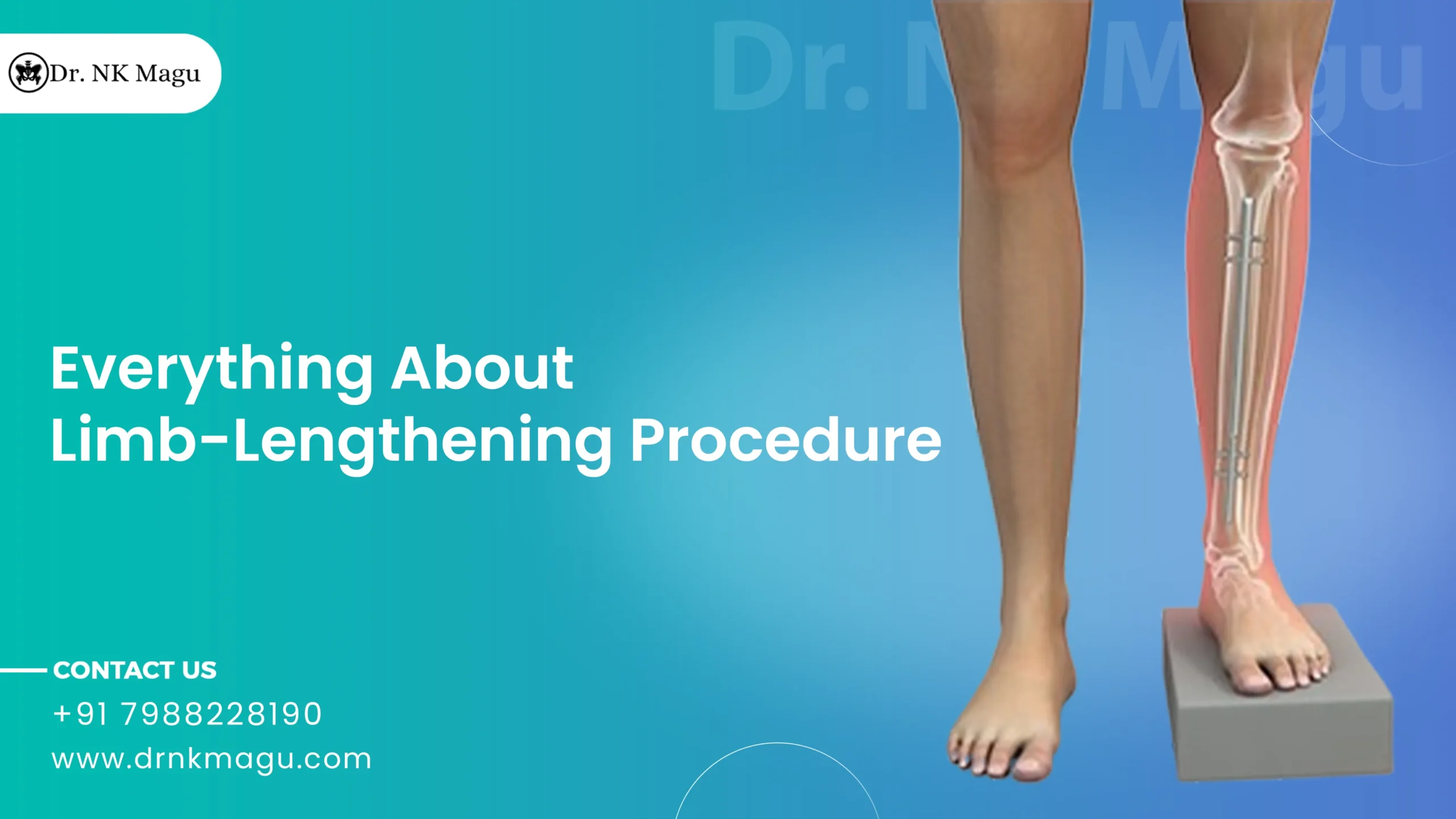 Limb Lengthening Surgery Height Increase Surgery Procedure