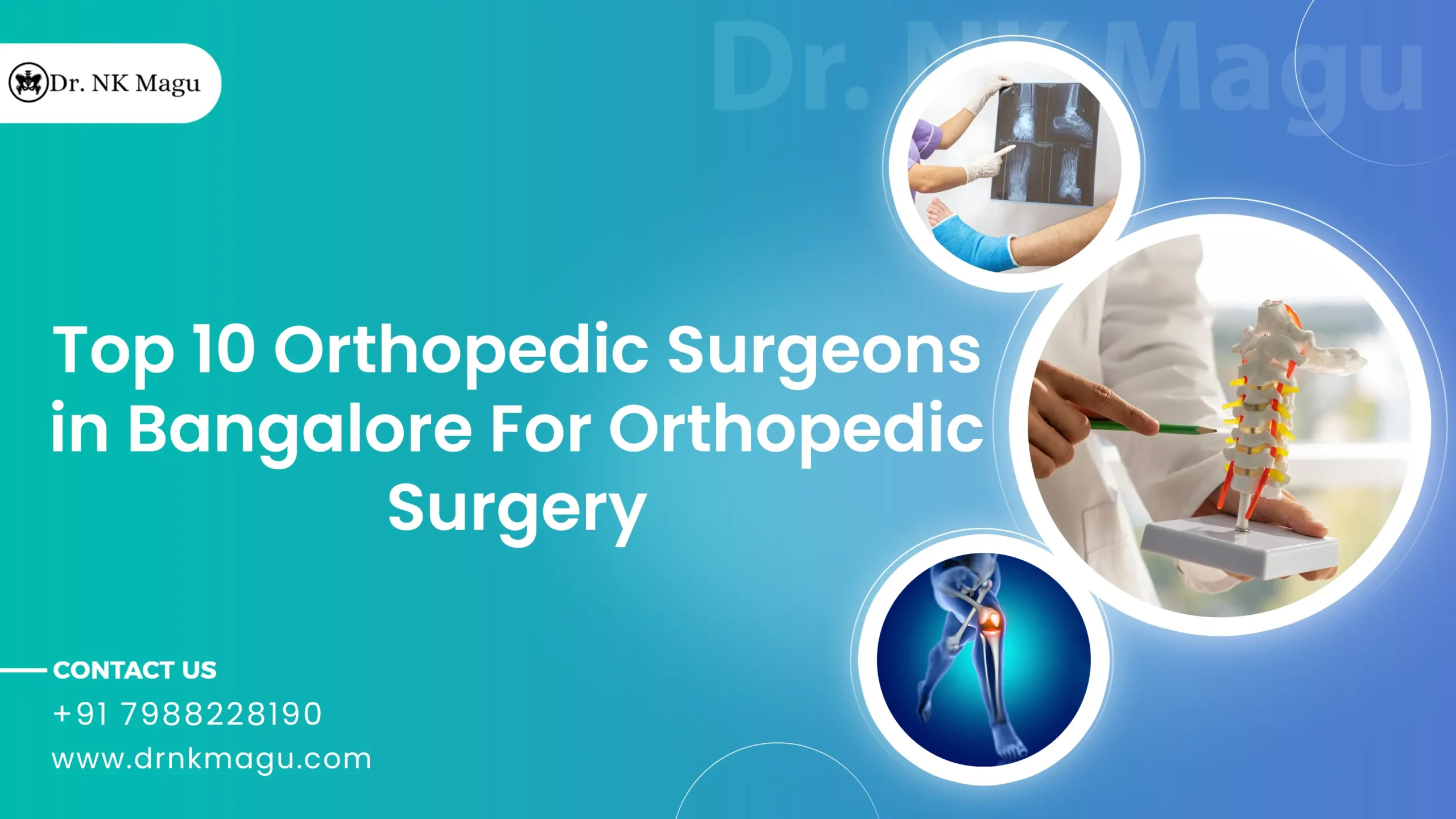 Top 10 Orthopedic Surgeons In Bangalore For Best Orthopedic Surgery