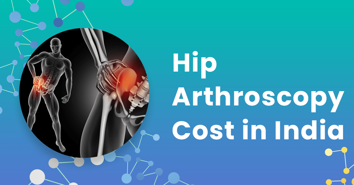 Hip Arthroscopy Cost in India