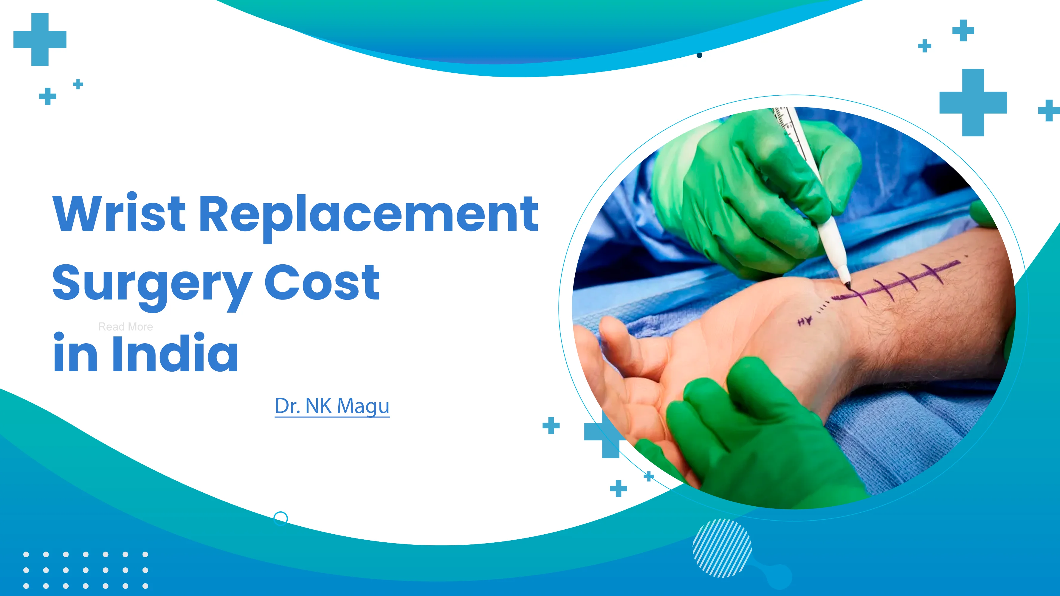 Wrist Replacement Surgery Cost in india.png