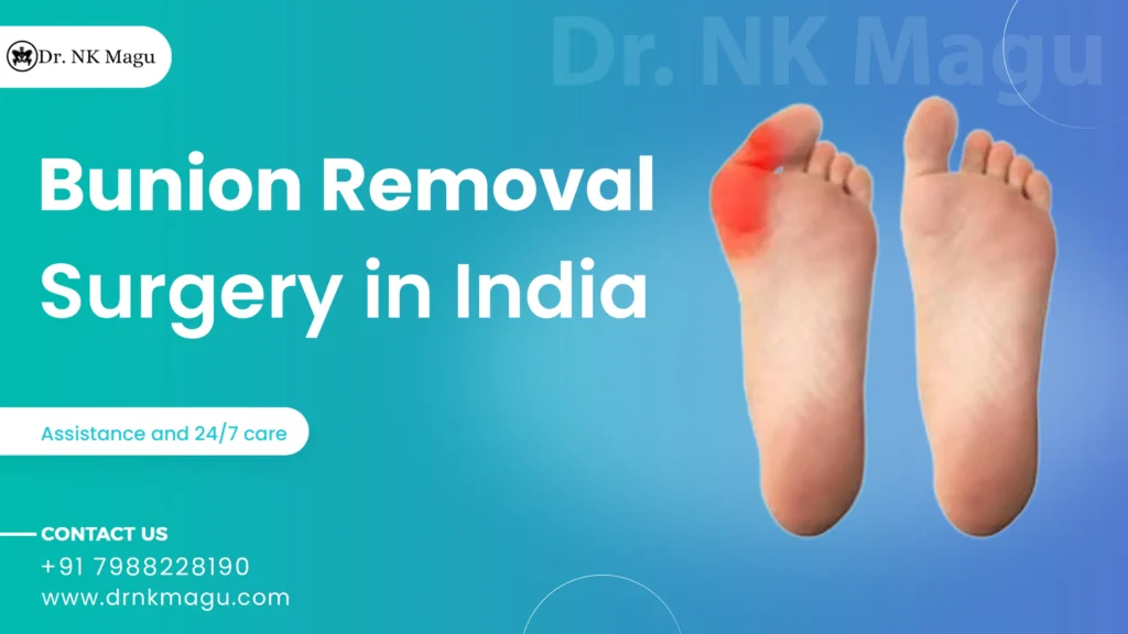 Bunion Removal Surgery Cost in India