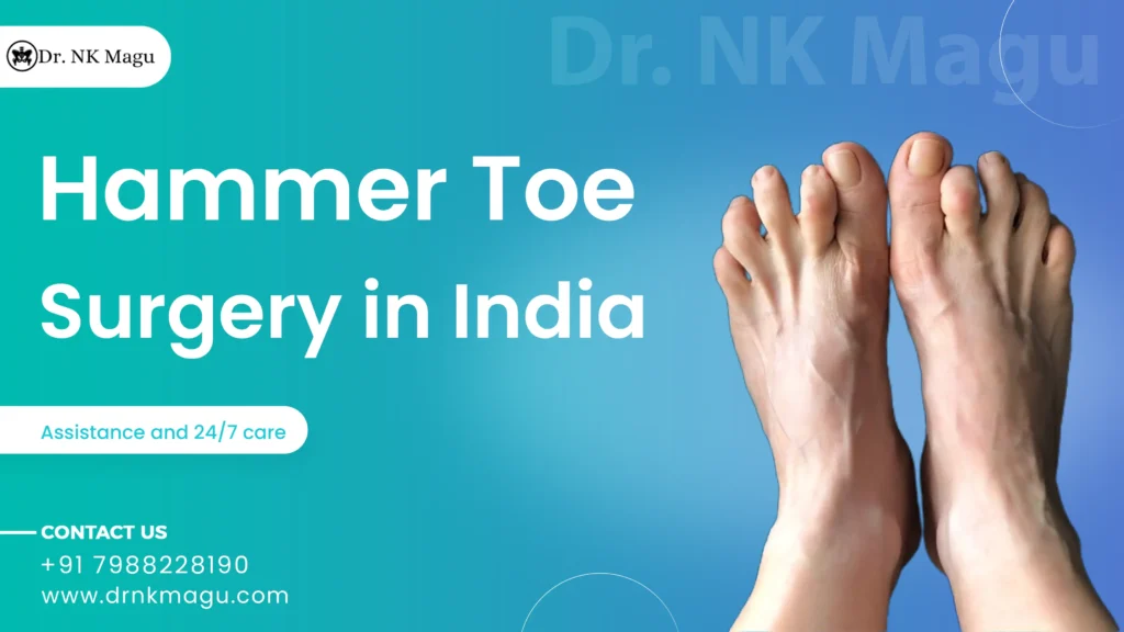 Hammer Toe Surgery Cost in India