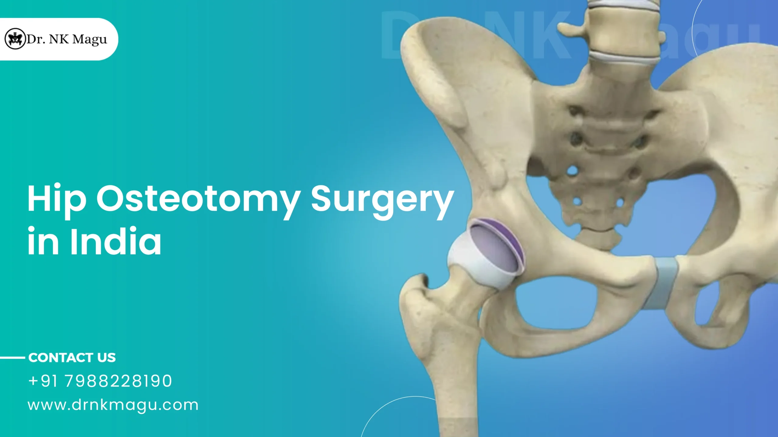 Hip Osteotomy Surgery Cost in India