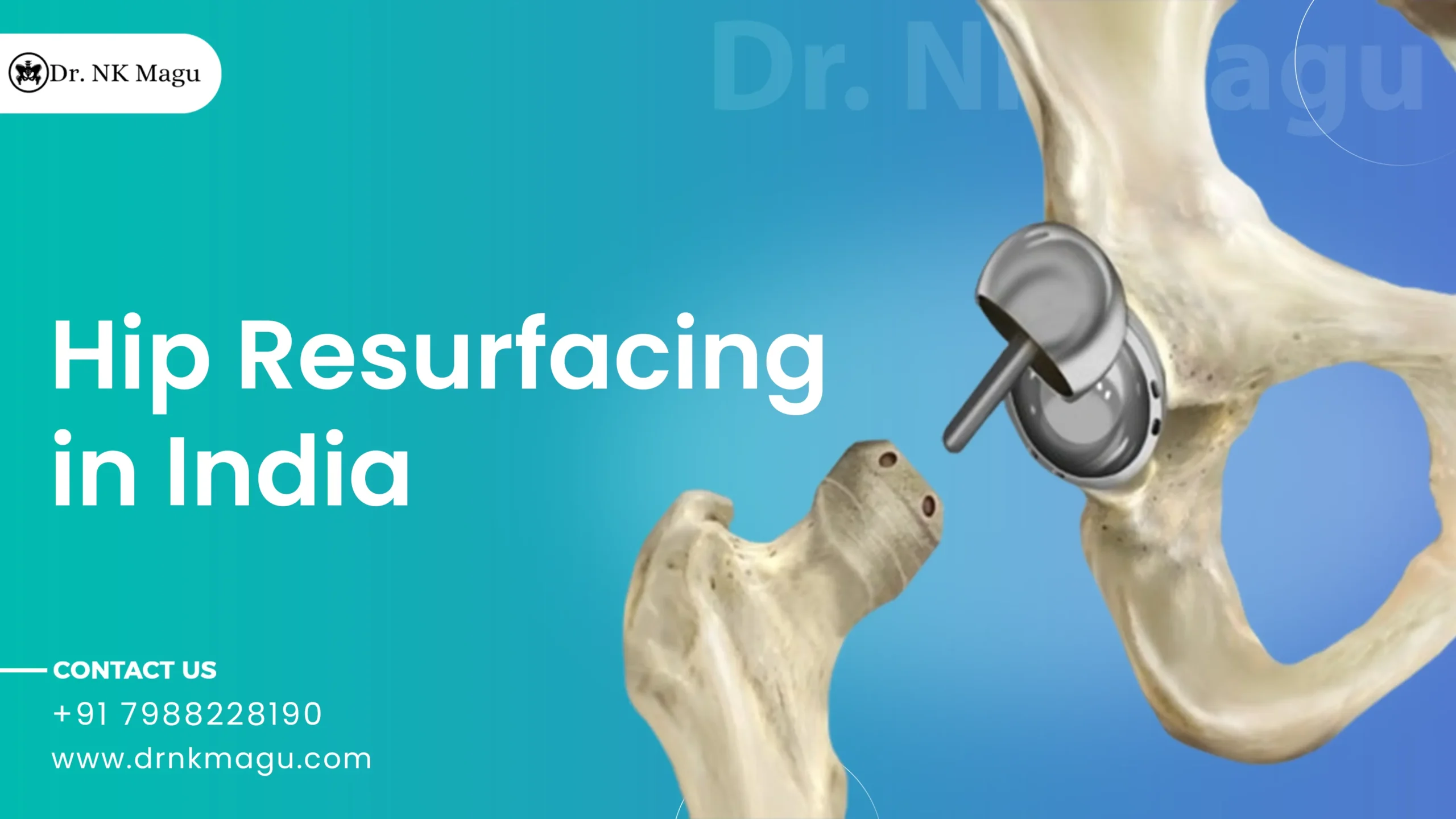 Hip Resurfacing Cost in India