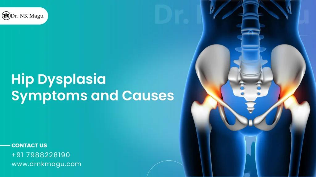 Hip Dysplasia