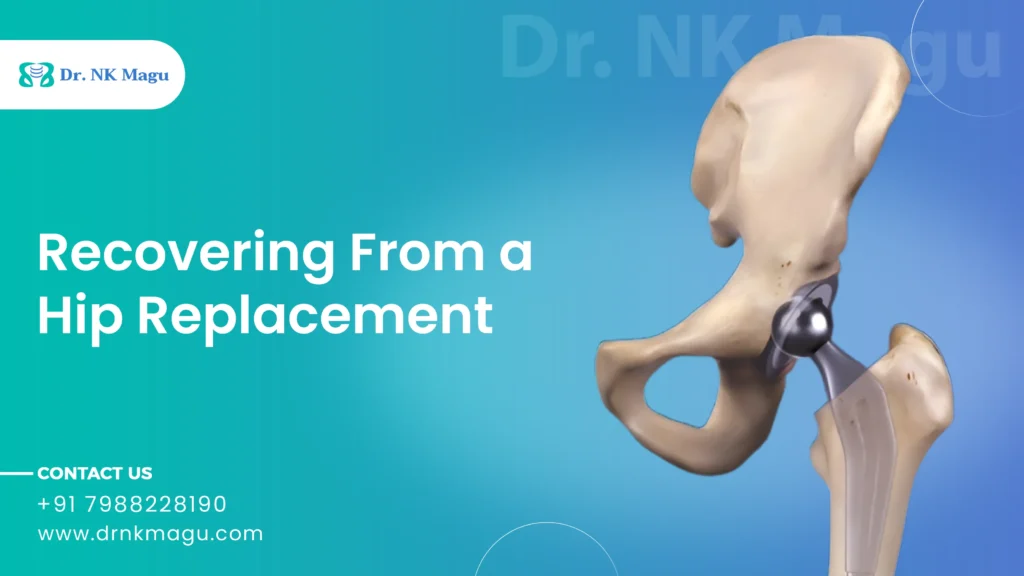 Recovering From a Hip Replacement