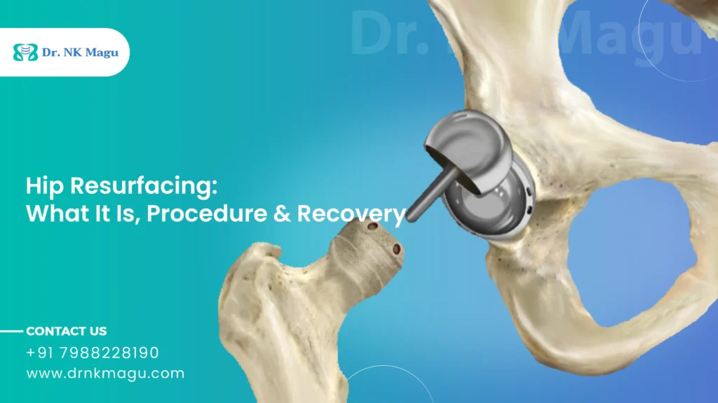 Hip Resurfacing
