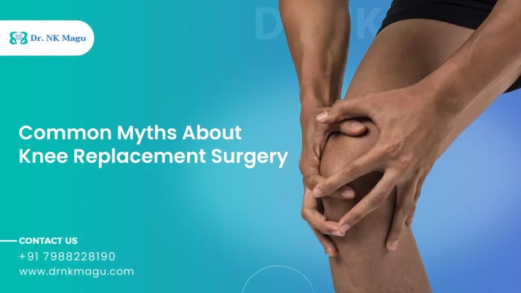 Common Myths About Knee Replacement Surgery