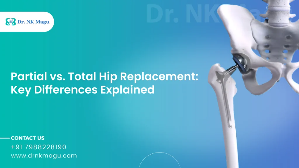 Partial vs. Total Hip Replacement