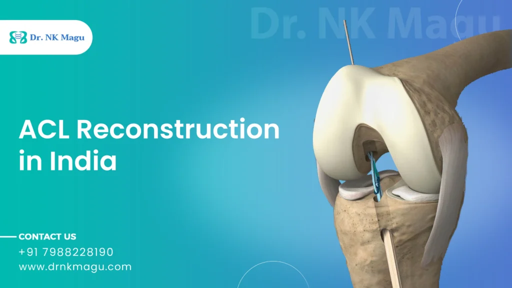 ACL Reconstruction Cost in India