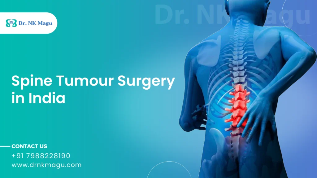 Spine Tumour Surgery Cost in India