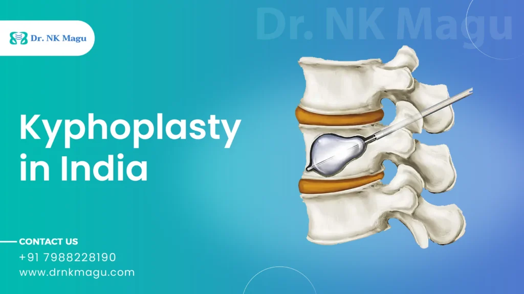 Kyphoplasty Cost in India