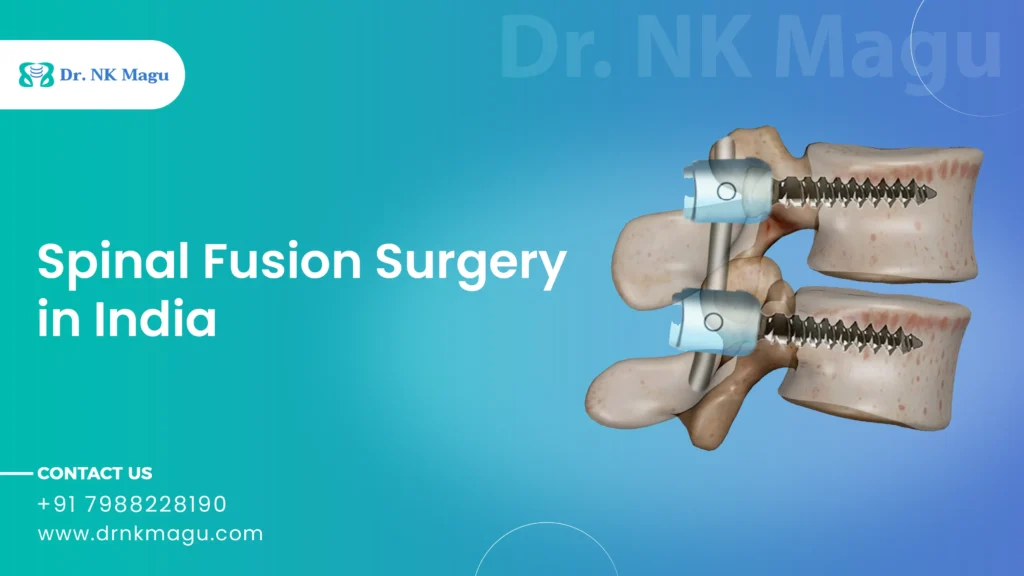 Spinal Fusion Surgery Cost in India