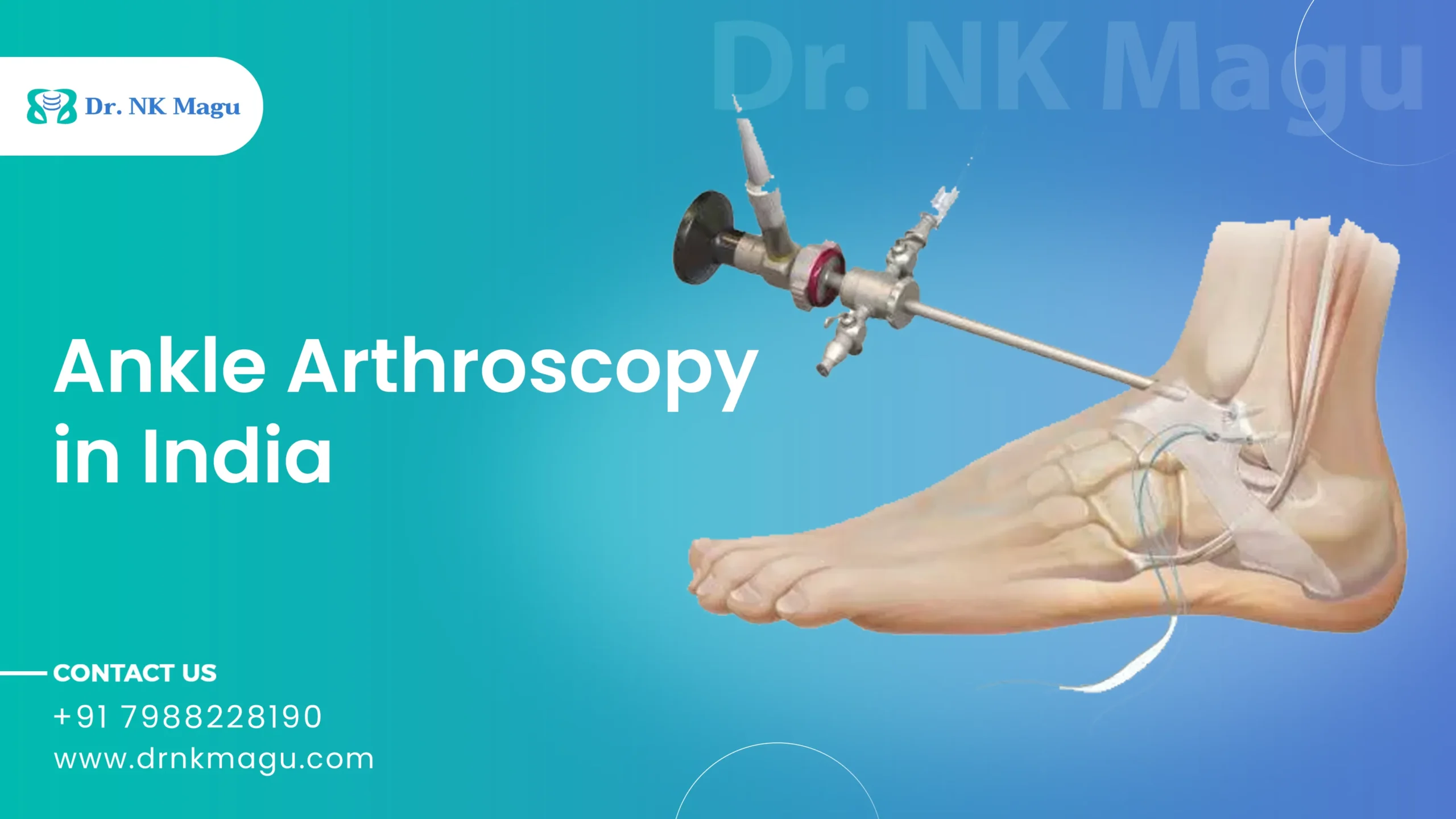 Ankle Arthroscopy Cost in India