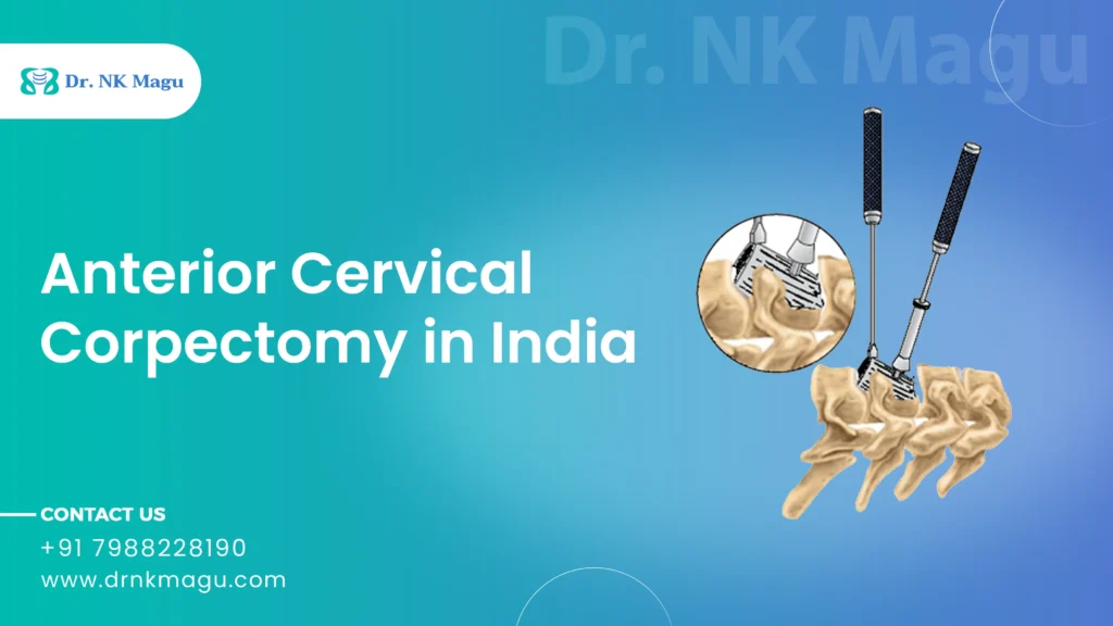 Anterior Cervical Corpectomy Cost in India