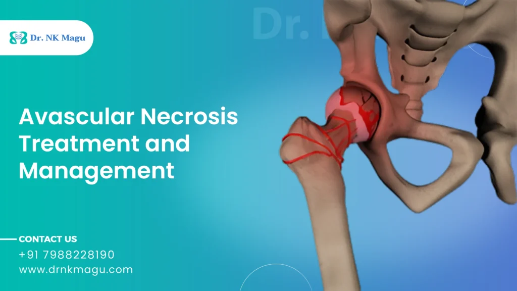 Avascular-Necrosis-Treatment-Management
