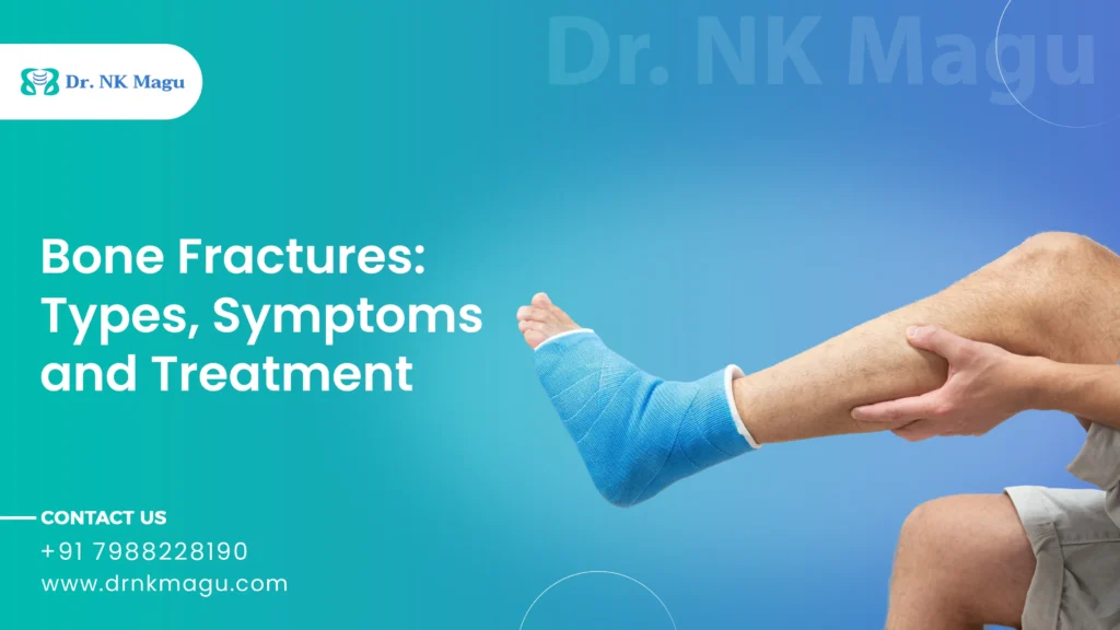 Bone Fractures: Types, Symptoms & Treatment