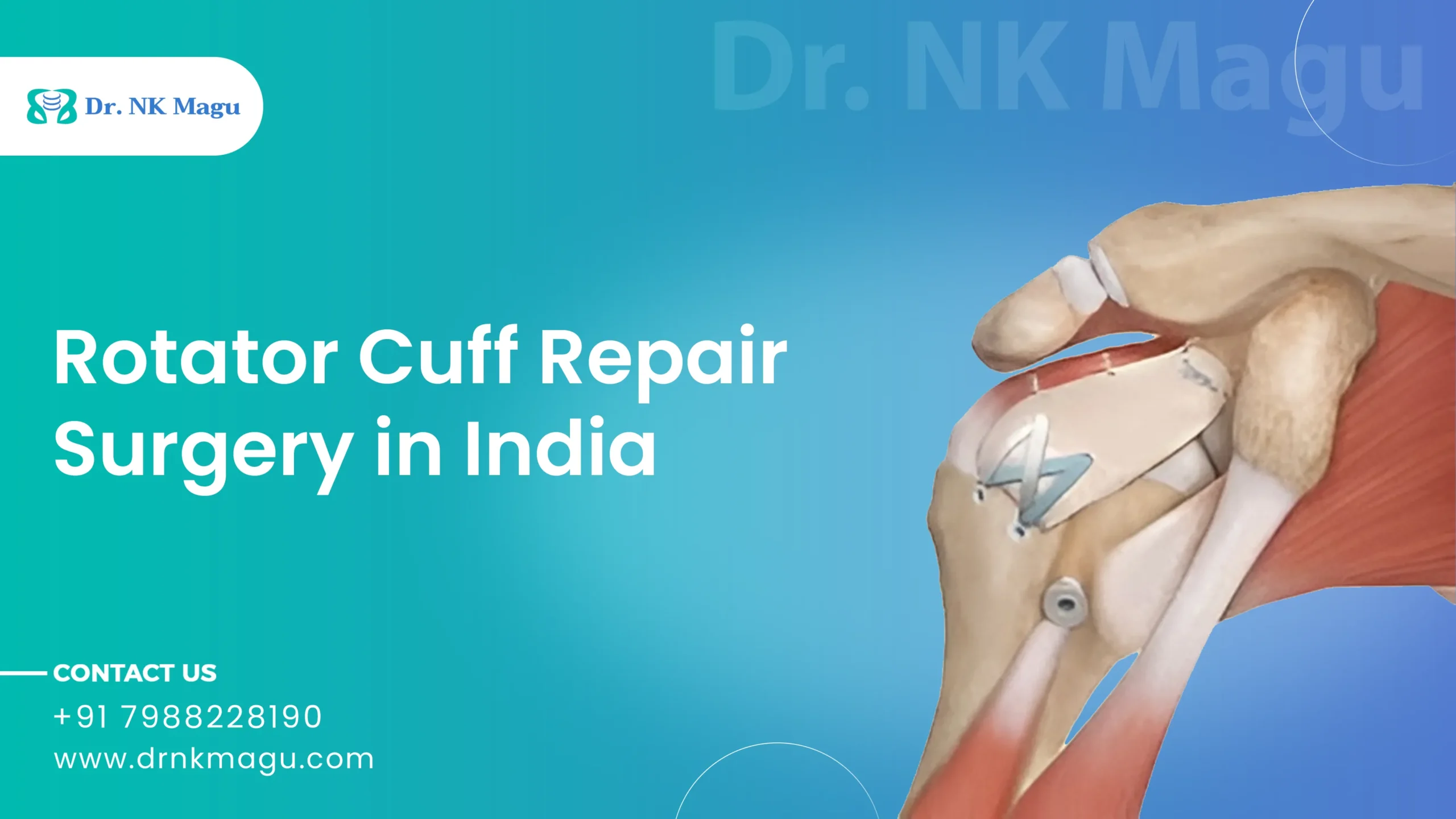 Rotator Cuff Repair Surgery Cost in India